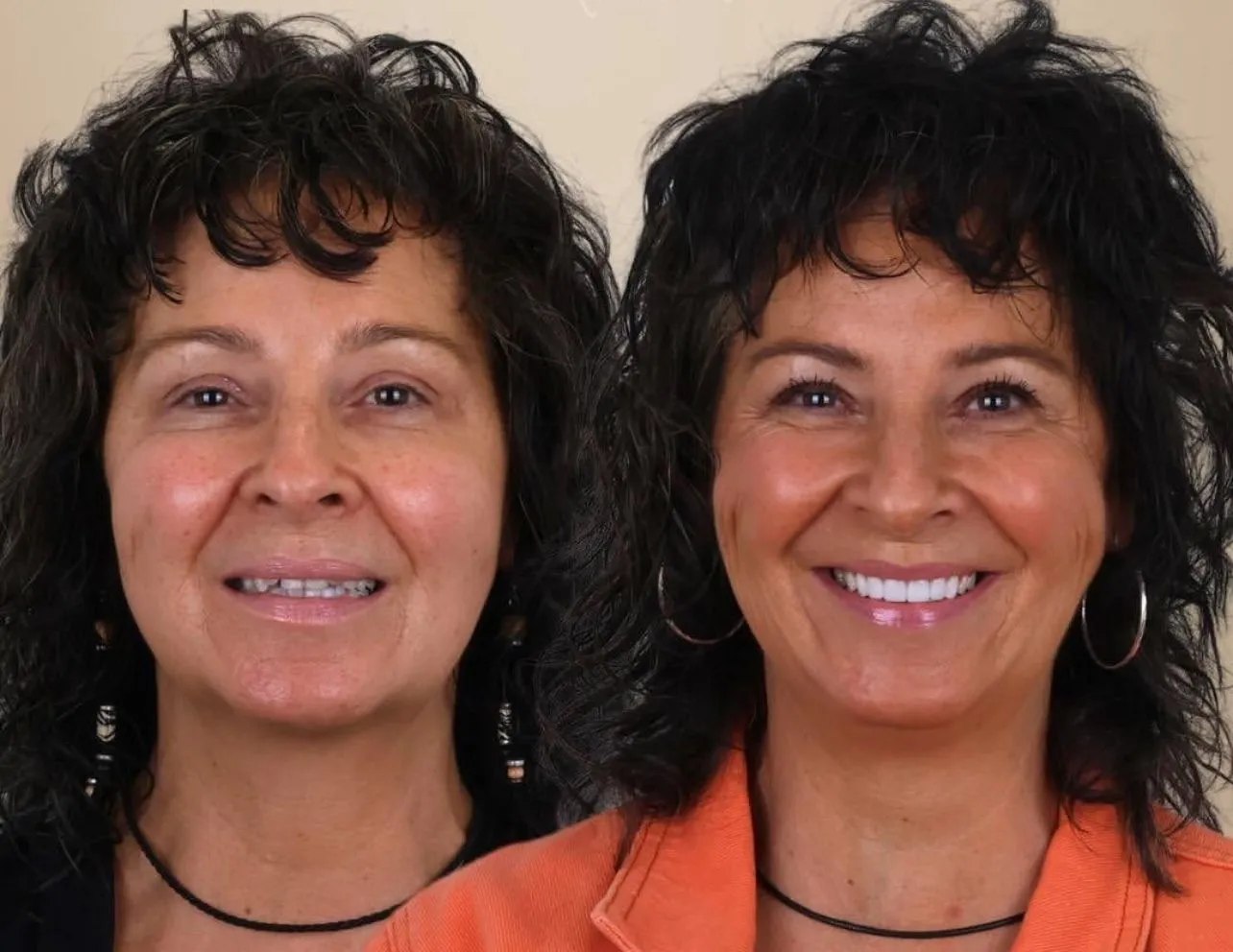 Dental Result 1