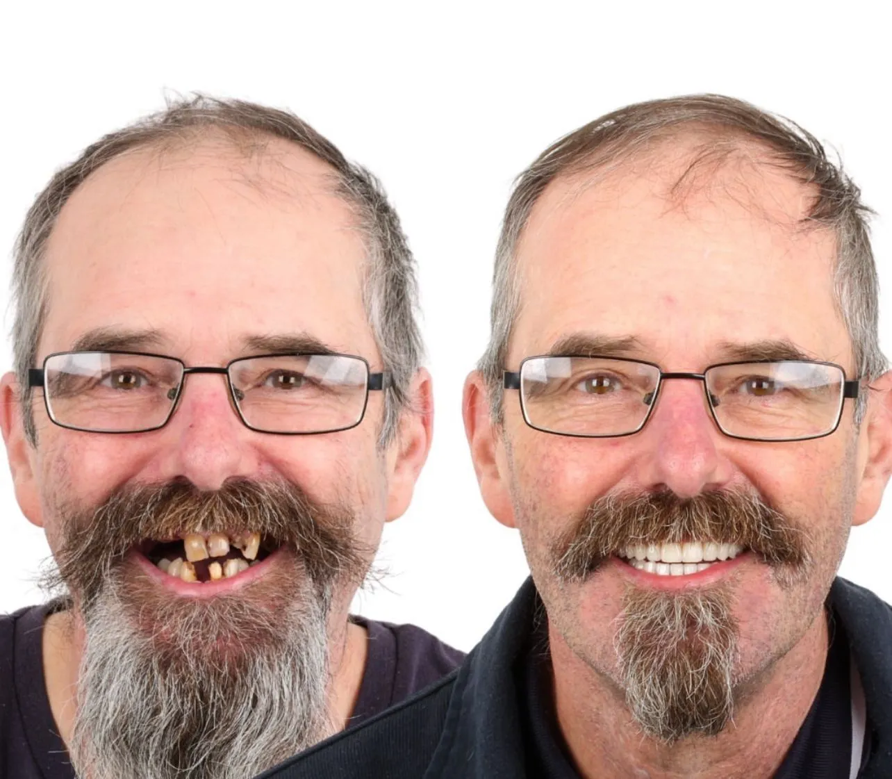 Dental Result 3