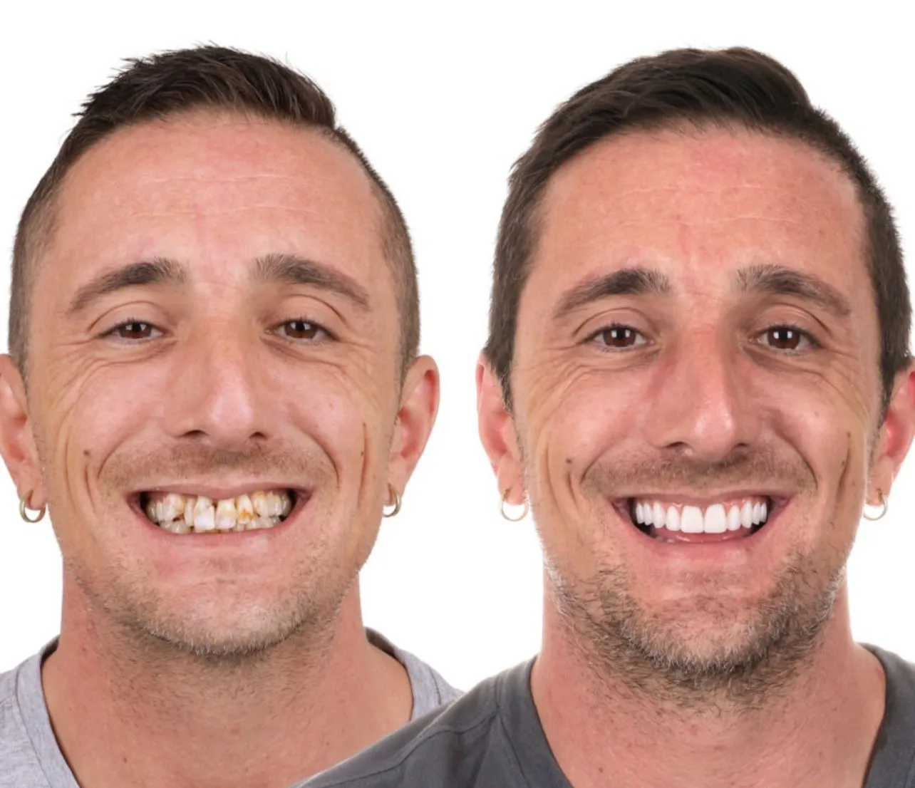 Dental Result 4