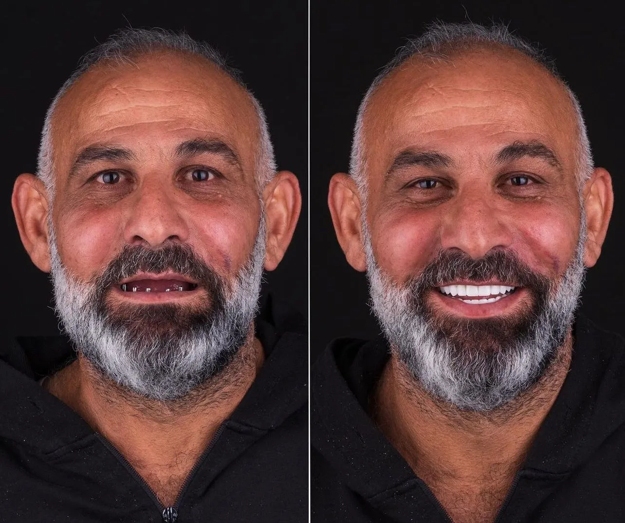 Dental Result 5
