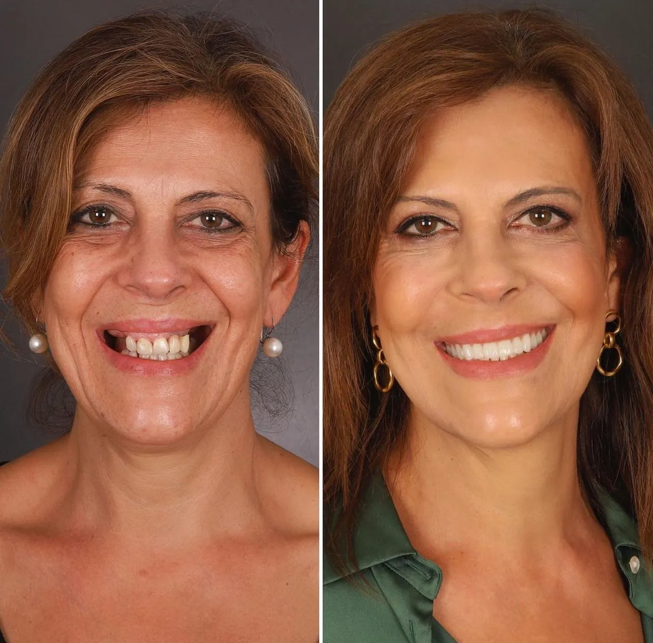 Dental Result 6