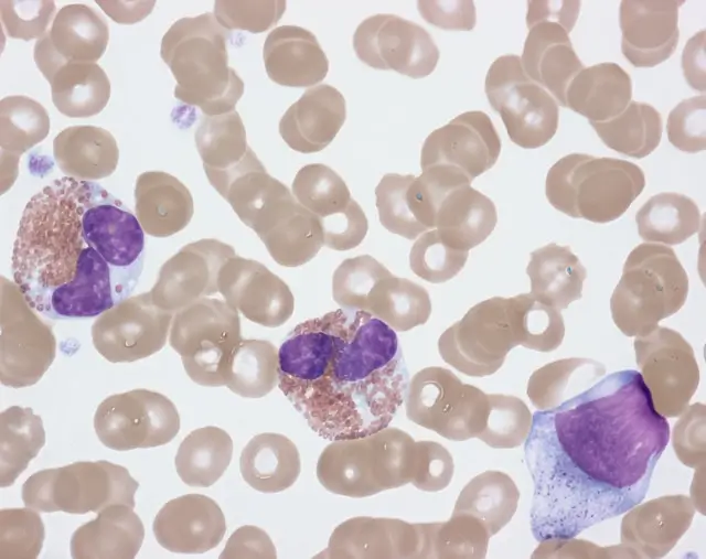 Kanalar Oncology