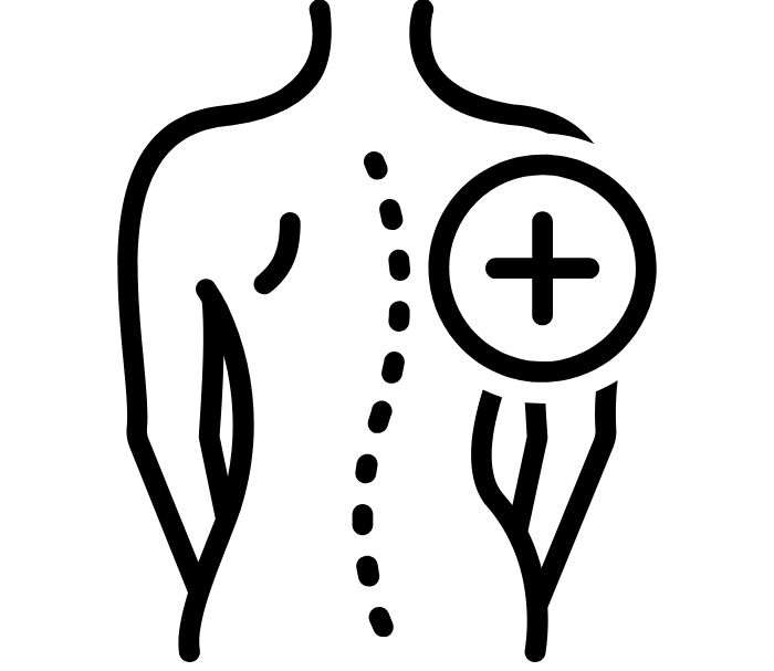 Kanalar Scoliosis